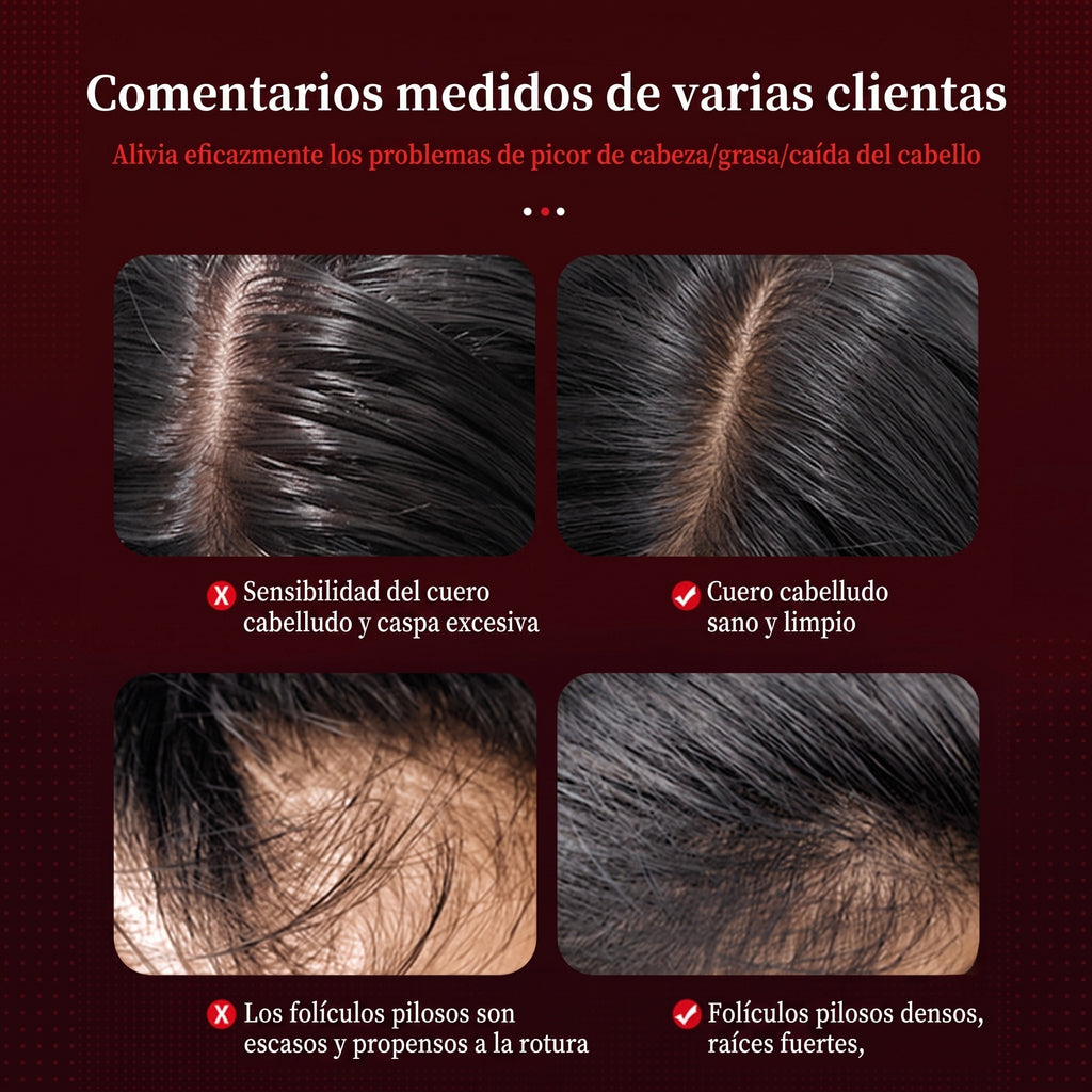 Masajeador Capilar con Terapia de Luz Roja y Depósito para Sérum